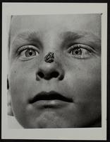 Small toad on nose - Stanley Smith of Liberal, KS.